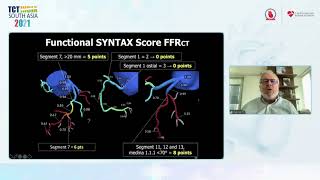 TCT 2021 | Nuclear Cardiology & Cardiac Imaging | Dr Patrick Serruys | London | Arena 2 - Day 3