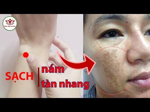 TRỊ TẬN GỐC NÁM TÀN NHANG TỰ TIN ĐÓN TẾT CHỈ 2 PHÚT MỖI NGÀY BẰNG CÁCH NÀY| YEN NHI & LIFE