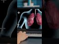 Interstitial Lung Disease ILD Did You Know These Facts About Interstitial Lung Disease 