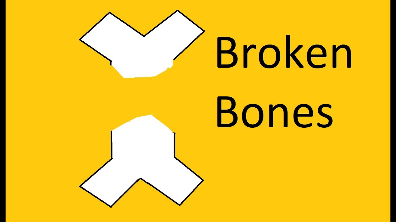 Broken Bones 4 Roblox. Break bones 4