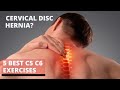 4 Best Cervical Disc Herniation Exercises| c5 c6 neck pain exercises