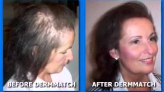 DermMatch Hairloss Concealer