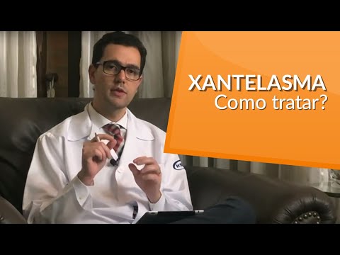 Vídeo: Pálpebras De Xantelasma - Tratamento, Remoção