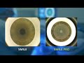 Le smile vs smile pro  chirurgie laser pour la myopie