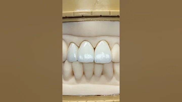 Monet Pure #Zirconia Incisor #Crowns @EnvisiontecMain #envisiontec#dental#teeth#smile#lsk121shorts