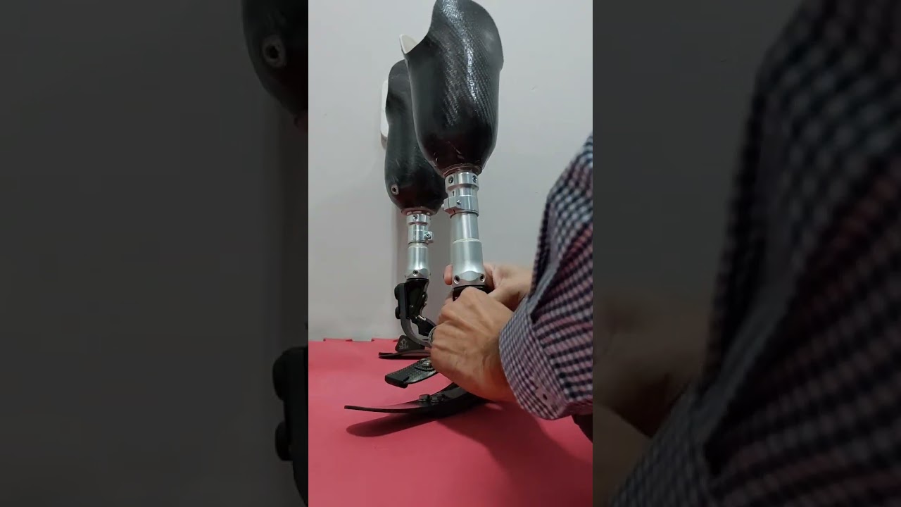 Prótese Endoesqueletica Transtibial com pé em fibra de carbono #amputação #fortaleza