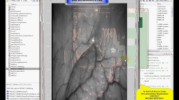 Laryngeal Tumor Detection and Classification in Endoscopic Video