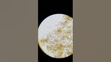 nematodes under the microscope