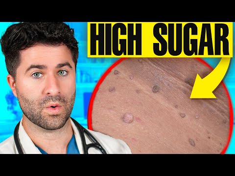 What Your SKIN Says About Your HEALTH: Doctor Explains