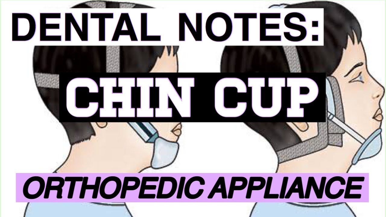 CHIN CUP II ORTHOPEDIC APPLIANCES II ORTHODONTICS YouTube