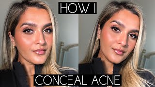 MAKEUP WITH ACNE | UPDATED TUTORIAL FOR HOW I COVER MY ACNE