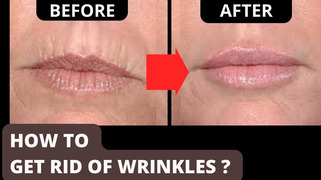 Get Rid of Wrinkles Around Your Mouth Fast – Try These Face Exercises