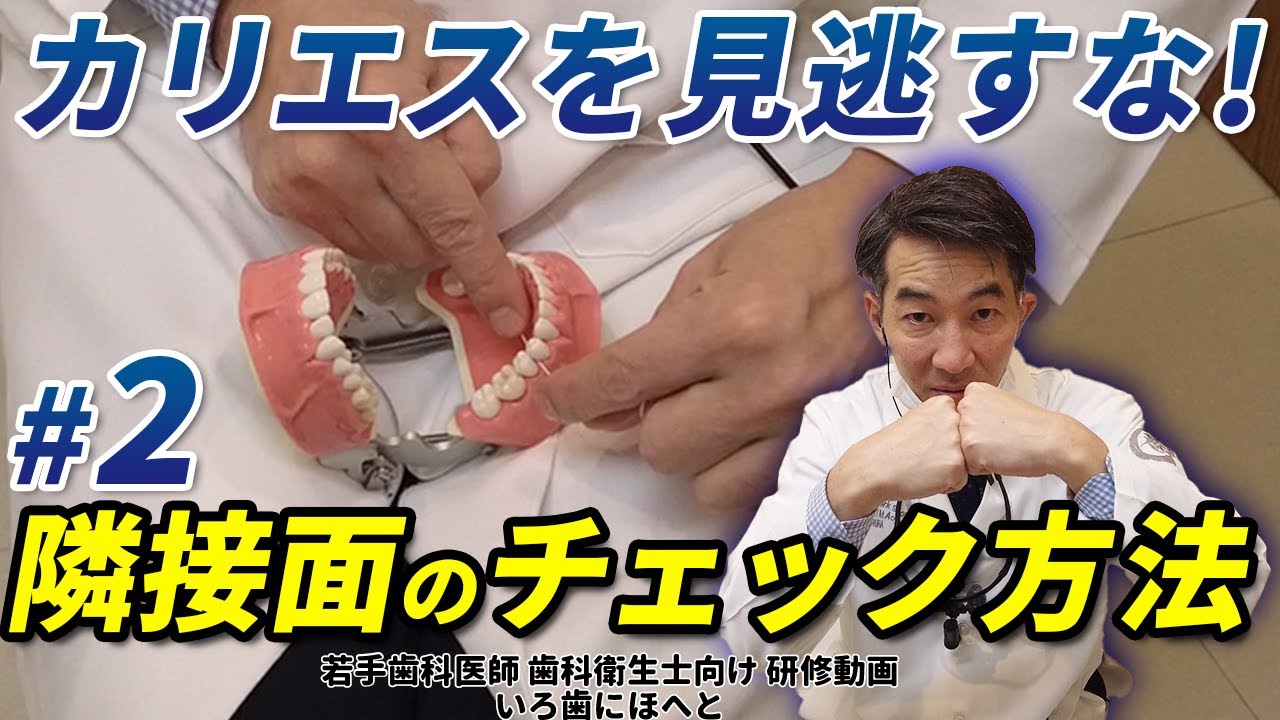 【カリエスを見逃すな！#2】隣接面カリエスのチェック方法と、隣接面以外のカリエス見逃しポイント