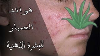 فوائد الصبار للبشرة الدهنية