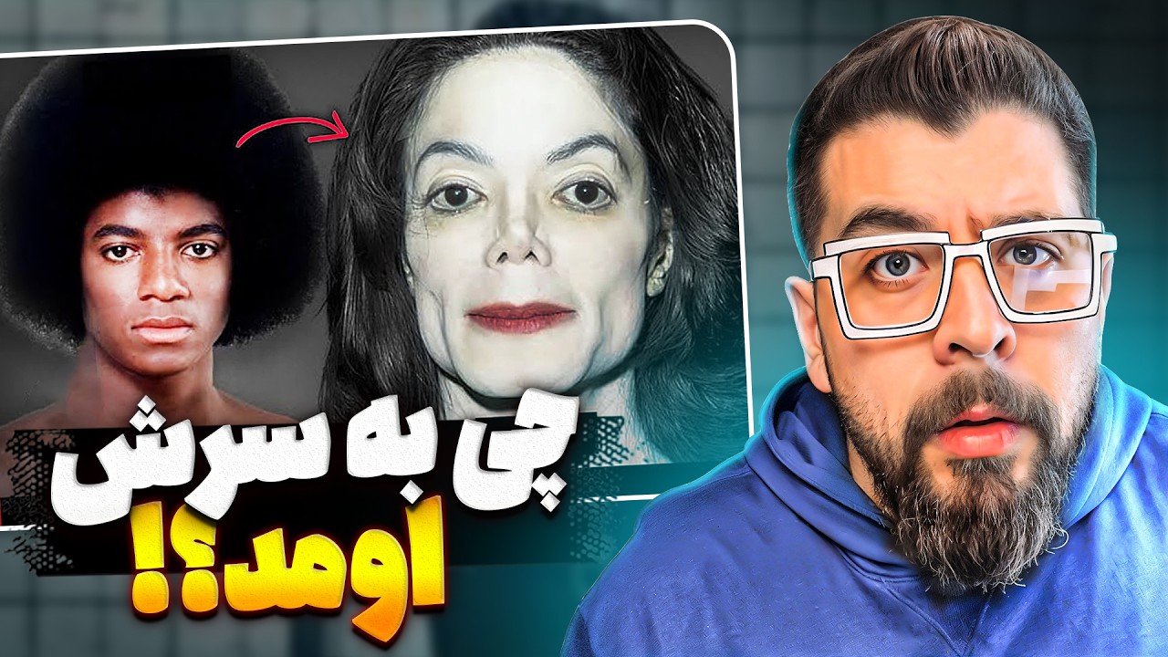 داستان واقعی جراحی‌های صورت مایکل جکسون  😱