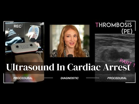 Using Ultrasound to