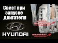 При запуске двигателя свист писк Hyundai (Хендай)