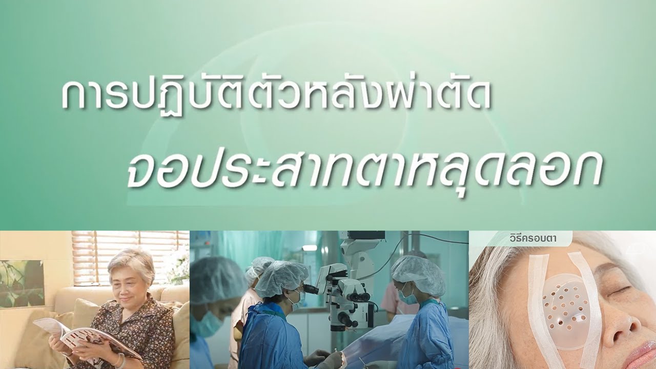 การปฏิบัติตัวหลังผ่าตัดจอประสาทตาฉีกขาดและหลุดลอก / รพ.จักษุ รัตนิน