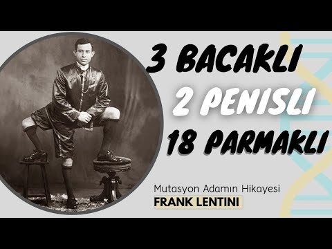 Video: Francesco Lentini, üç ayaqlı adam (foto)