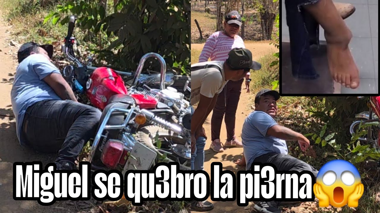 🚨Emergencia Miguel se qu3bro la pierna esto no puede ser dice llorand0🚨