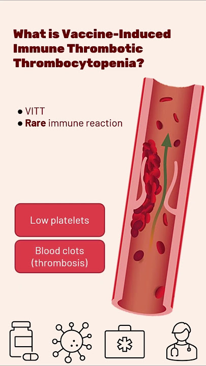 Vaccine-Induced Immune Thrombotic Thrombocytopenia (VITT) #shorts