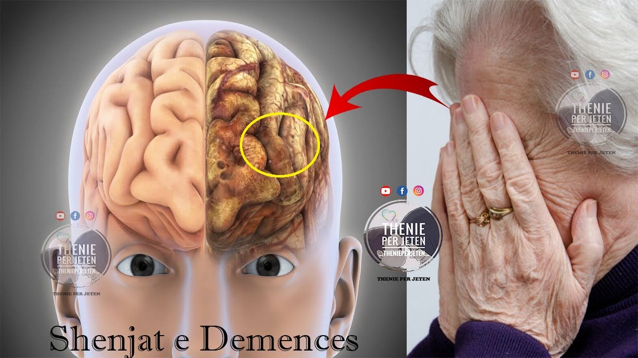 Mos i neglizhoni keto jane shenjat e Demencës: Ja kur duhet të shkoni tek mjekeu