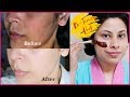Best De-Tanning Face Pack for SUMMER / Get Bright Glowing Skin || Arpita Nath