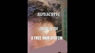 Hair System See This Video Before To Buy It You Can Win O