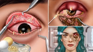 ASMR The best treatment for swollen eyes, eyelids and lacrimal glands secreting mucus, red eyes