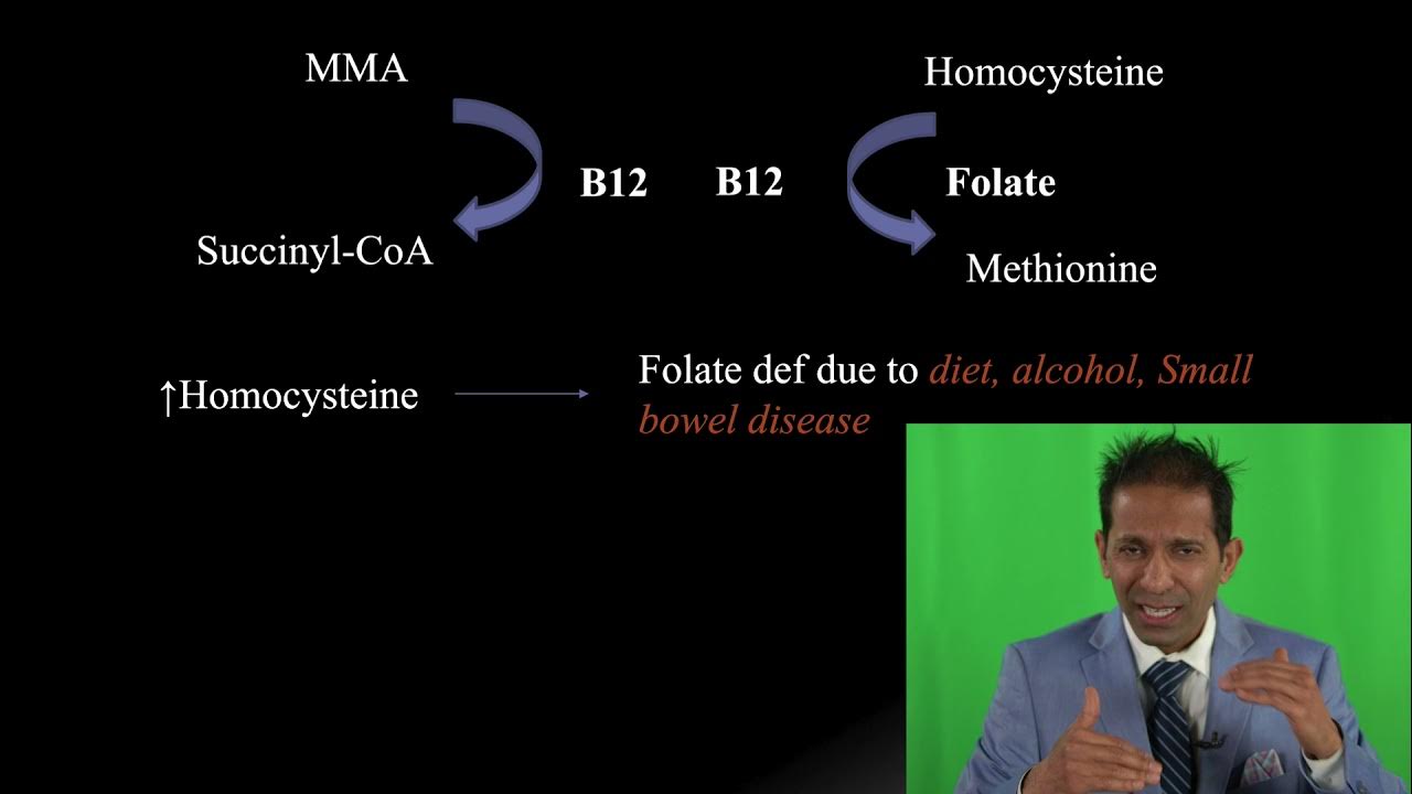 Vitamin B12 and Folate Deficiency YouTube