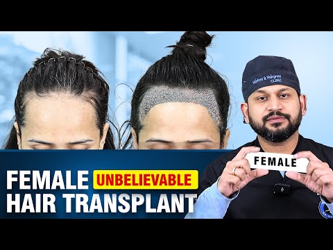 Female Hair Transplant