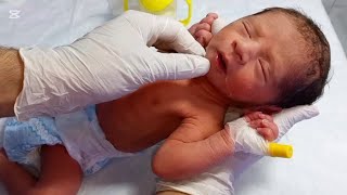 IUGR Baby NICU Care | Management, Starting Feeding &amp; Good Condition