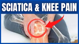 Does Sciatica Cause Knee Pain?