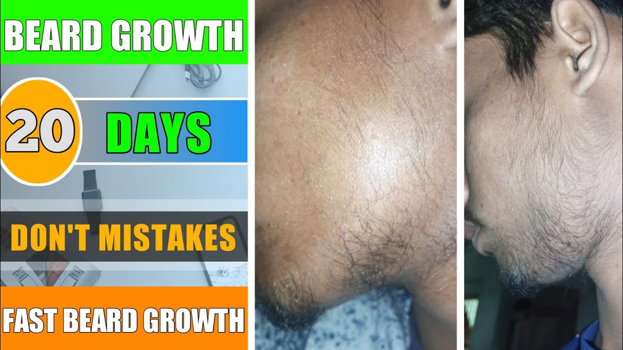 beard-growth-in-20-days-don-t-mistake-in-beard-growth-journey