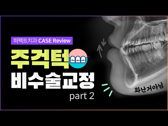 성인 주걱턱 비수술교정 + MARPE교정 결과는?👍