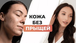 Как избавиться от прыщей раз и навсегда!