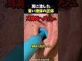 耳に流した青い液体の正体