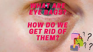 FAQ - What are eye bags and how do we get rid of them? Dr Anthony Maloof, Sydney Australia