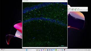 Cuantificación manual de microglía en ImageJ (guía paso a paso)