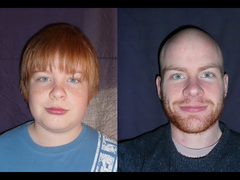 Photo A Day For 15 Years (Age 13 to 28)