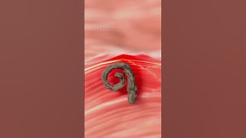 Vì Sao Không Nên Nhổ Lông Mọc Ngược #shorts