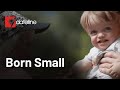 Dwarfism and the drug that could change everything | Full episode | SBS Dateline