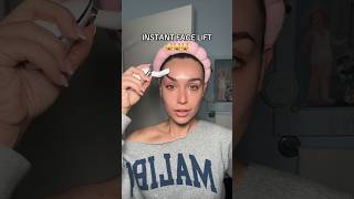 I CAN’T BELIEVE THIS HAPPENED ✨️ #hyperpigmentation #acnetreatment #acnescars #clearskin #darkspots