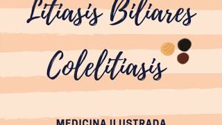 Colelitiasis (cálculos o piedras Biliares)