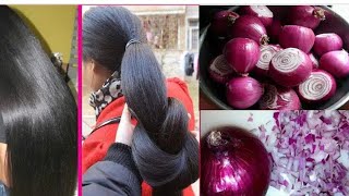 മുടി തഴച്ചു വളരാൻ ഉള്ളി നീര് എങ്ങനെ ശരിയായ രീതിയിൽ ഉപയോഗിക്കാം How To Use Onion Juice For Hair