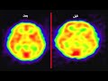 أحمد الشقيري قام بعمل أشعة مقطعية للدماغ قبل الصلاة وبعد الصلاة - شاهدوا أثر الصلاة على الدّماغ