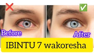 Tandukana namaso atukuye redeyes ibyo wakoresha ugakira amaso atukuye