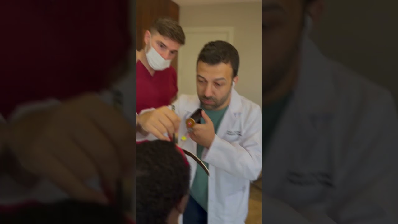 Best Hair Transplantation