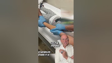 The “Yank” Method for Arm Fractures #shorts