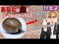 #10【狩猟】致死率30％！？マダニ感染症の恐ろしさ！Nozomi講座★ Lethal rate 30%! ? Terror of tick infection! Nozomi course【狩女子】